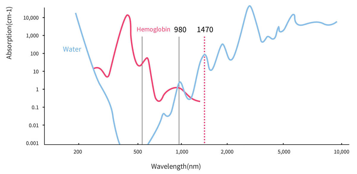 980nm-1470nm-laser-diode principle